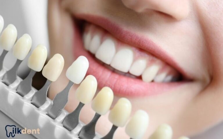 Bayrampaşa Lamine Kaplama ile Kusursuz Gülüşler