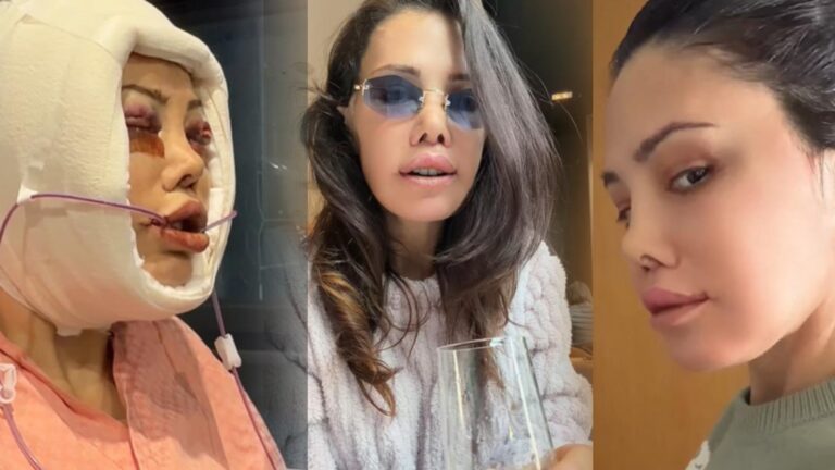 Didem Ceran Kore’de yüz nakli yaptırmıştı! ‘Cenazen ülkeye dönsün’ yorumlarına sert çıktı